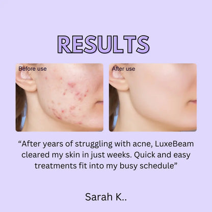 Dual Light Acne Therapy